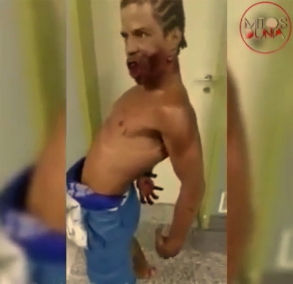 Haberini yaptığı zombi hapı ile yakalandı