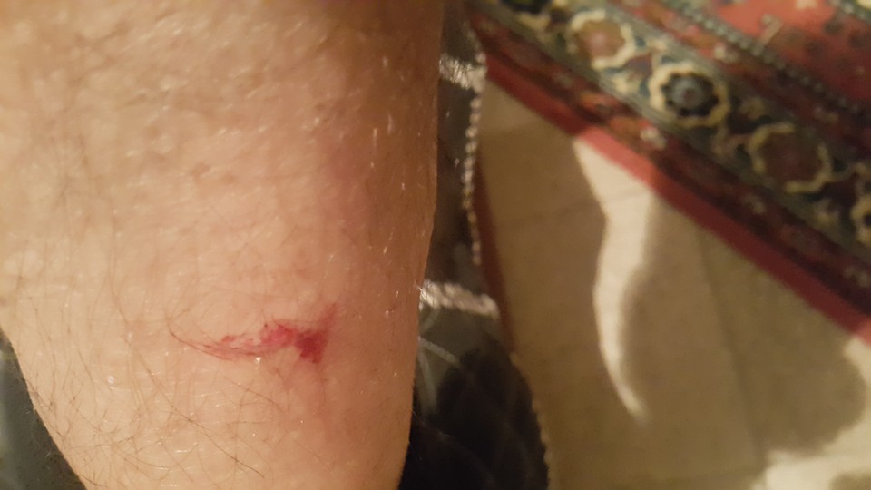 Başıboş Köpek Salih Erkek'i Isırdı