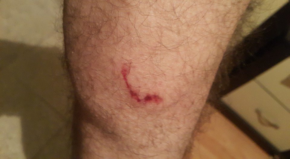 Başıboş Köpek Salih Erkek'i Isırdı