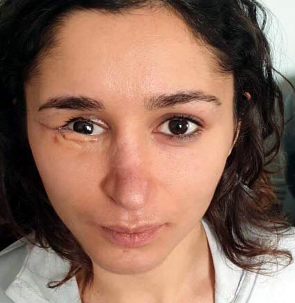 Dehşeti yaşayan Tuğçe, hukuk mücadelesi başlattı