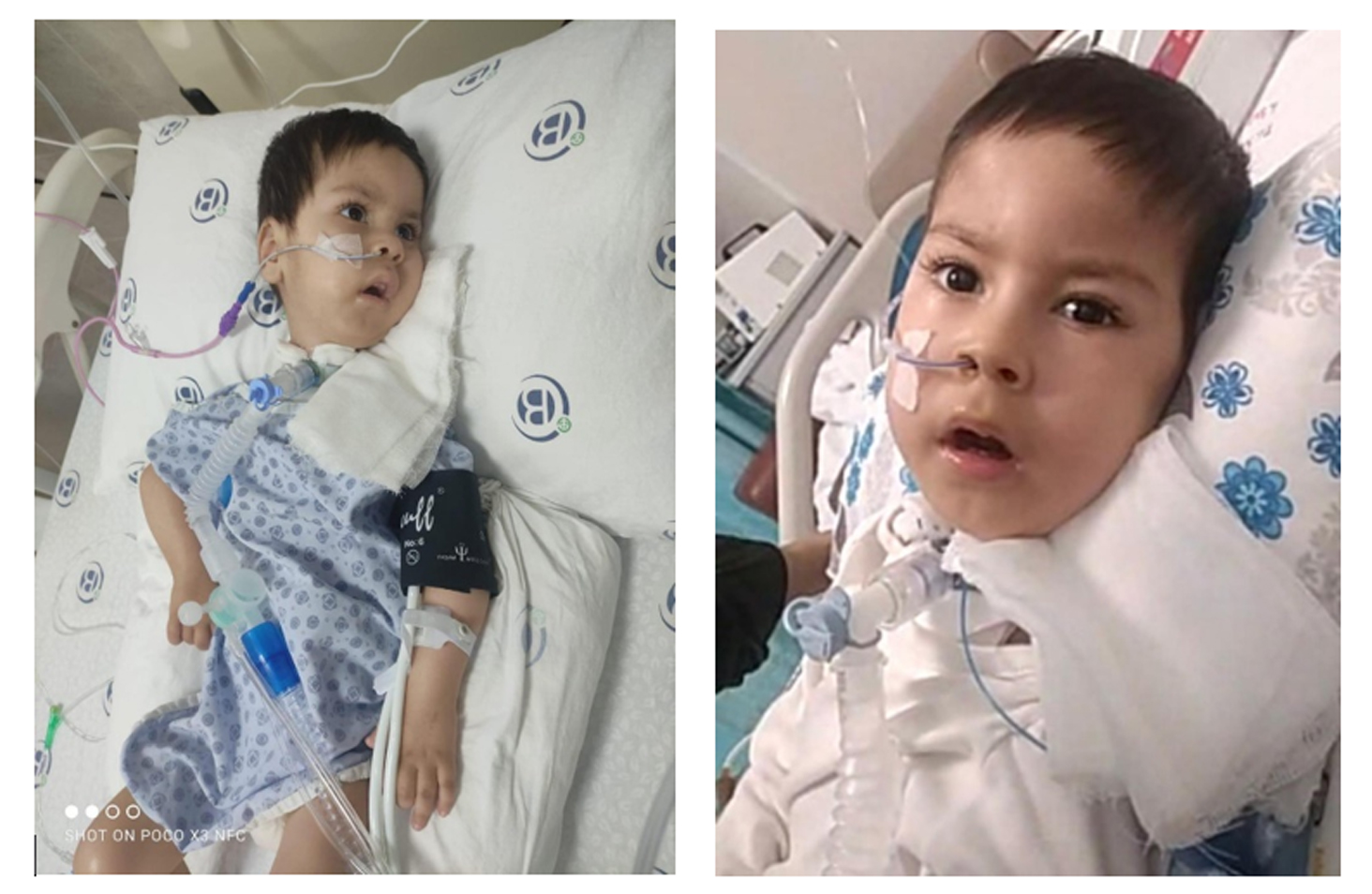 ALİ BEBEK İÇİN ELELE VERİYORUZ... #smalıbebeklerimizyaşasın