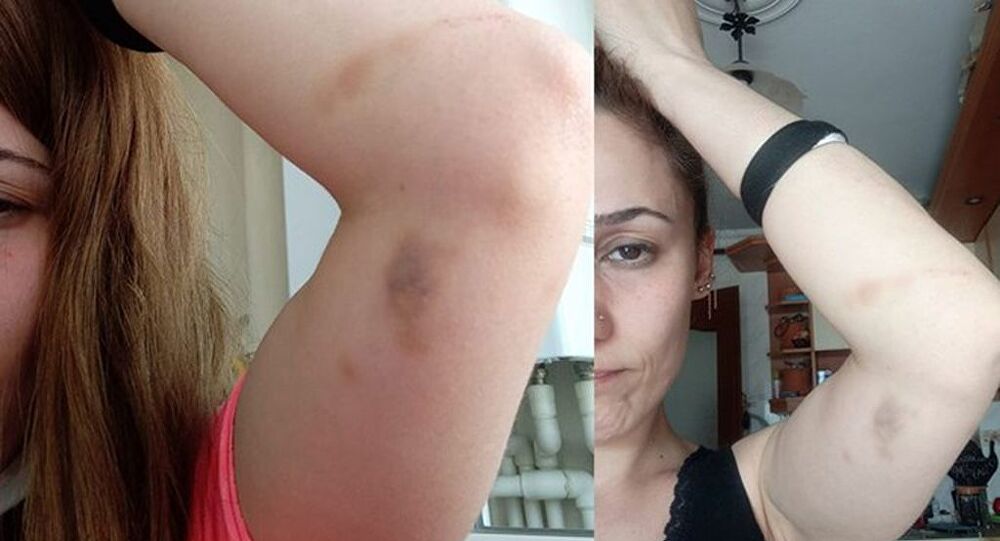 Çocuklarının gözü önünde darp… İzmir’de hakkını isteyen kadına patron dayağı!