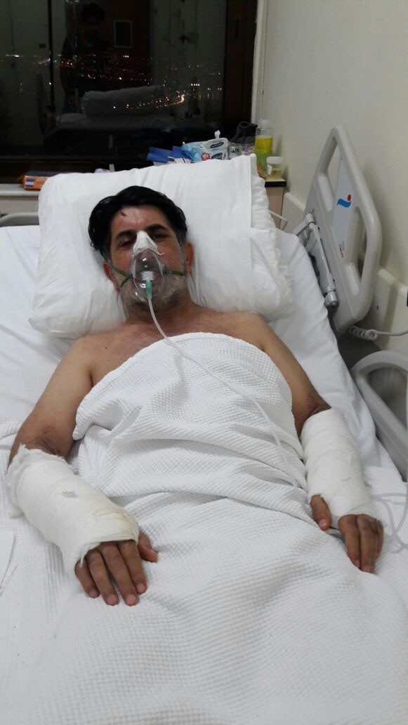 Gaspçıların saldırdığı adamın hayatı karardı