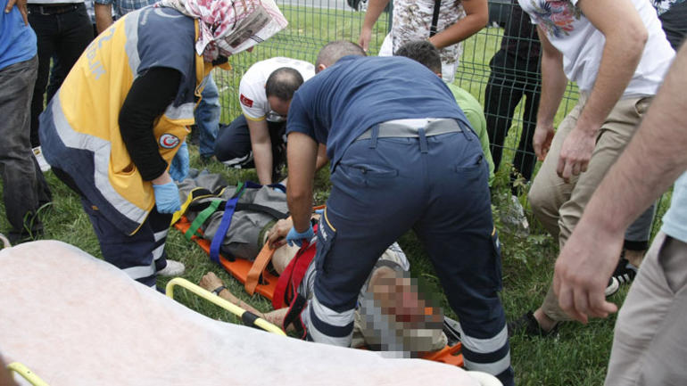 Feci kaza: Gözlüğü ve şapkası otomobilin camına yapıştı