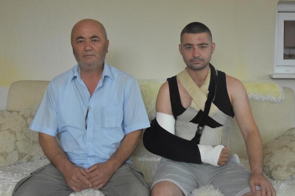 Onu bu hale getiren serbest