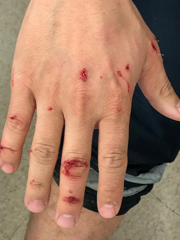 Saldırgan köpeği polisin kurşunu bile durduramadı