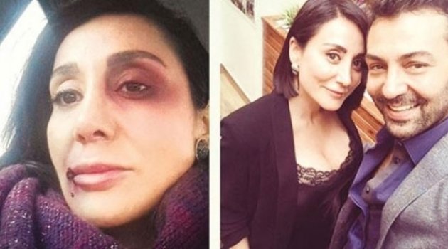 17 Yıl Hapsi İsteniyor!