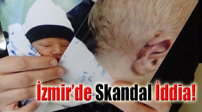 'Yeni doğan bebeğin hastanede kulağı koptu' iddiası