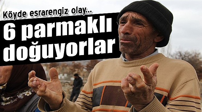 Esrarengiz olay... 6 parmaklı doğuyorlar!