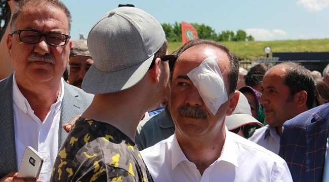 Başkanı gözünden yaralayan saldırgan tutuklandı