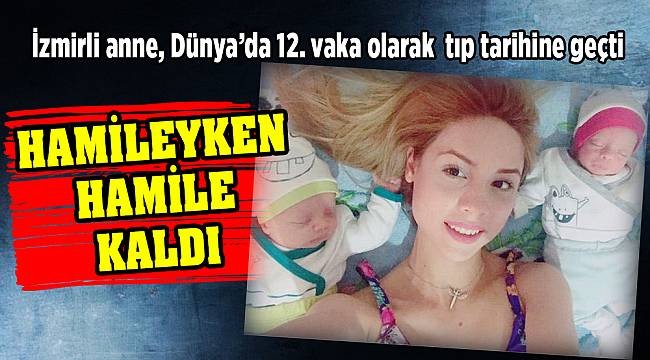 Hamileyken hamile kalan anne, bebeklerini doğurdu