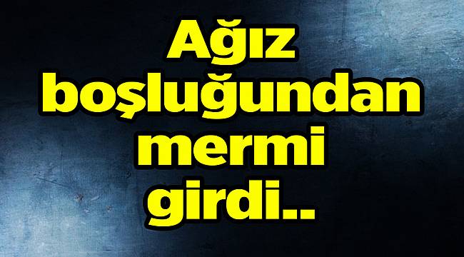 Ağız boşluğundan mermi giren bir kişi, ölümden döndü