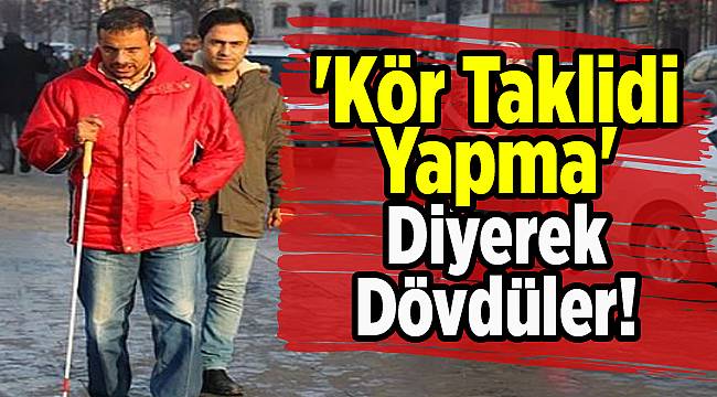 'Kör Taklidi Yapma' Diyerek Dövdüler!