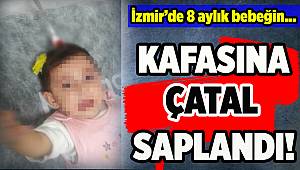 İzmir'de 8 aylık bebeğin başına gelen talihsiz kaza