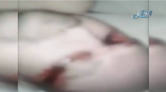 Hayatını kaybeden hastanın gözleri çalındı