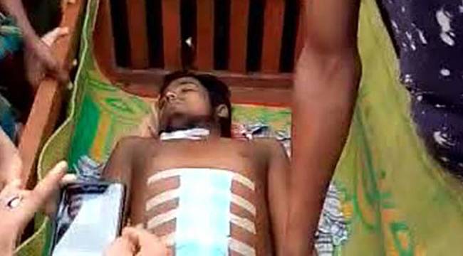 Bangladeş’te Arakanlı Müslümanın hastanede organları çalındı