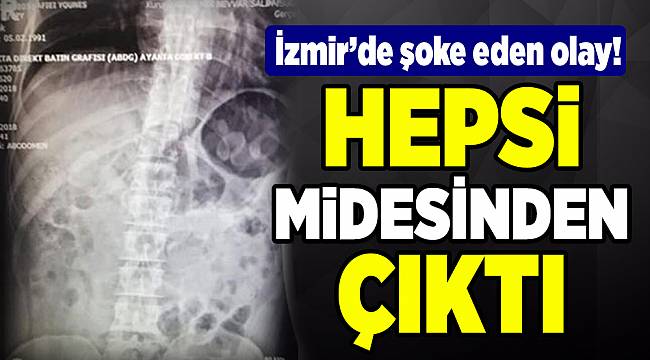 Midesinden 198 gram uyuşturucu çıktı