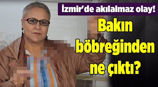 İzmir'de akılalmaz olay! Bakın böbreğinden ne çıktı?