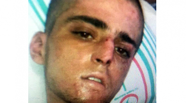 YPG'li teröristi narkoz ele verdi