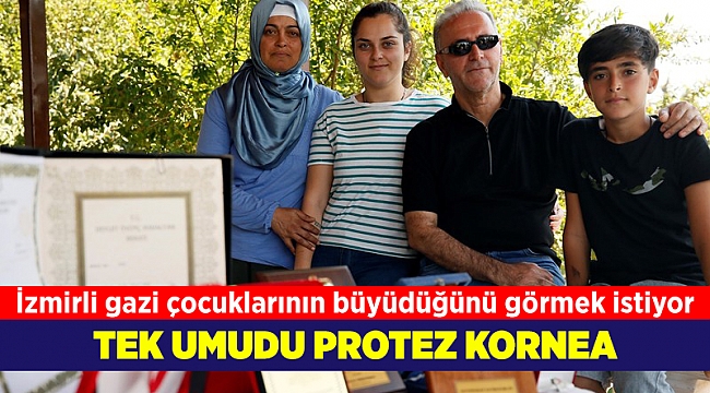 İzmirli gazinin tek umudu protez kornea