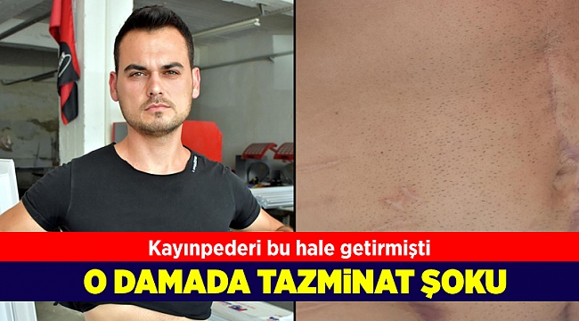 Kayınpederi tarafından vurulan damada tazminat şoku