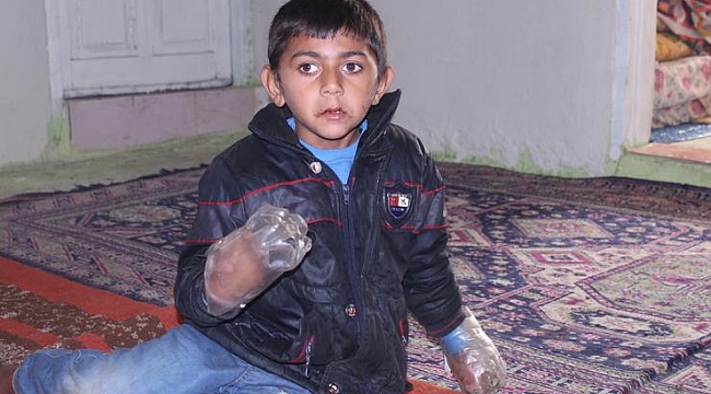 Minik Yusuf&#039;un dramı: Sürekli ısırdığı ellerini plastik şişeye bağlıyorlar