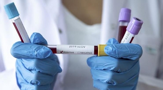 Corona kabusunda son durum: 24 saatte 114 ölüm!