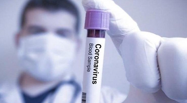 Corona Virüsü Bornova’da konuşulacak