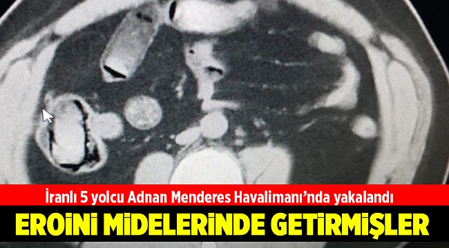 İranlı 5 yolcunun midesinden 3 kilo 385 gram eroin çıktı