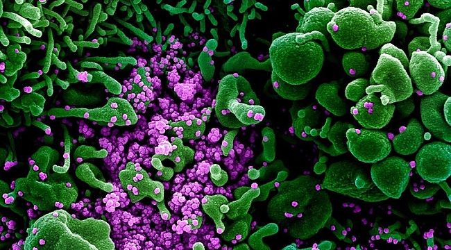 Adım adım görüntülendi! Koronavirüs insan hücrelerine ne yapıyor?