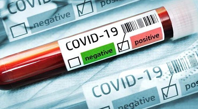 Corona virüsünde son durum: Milyarlarca insanı ilgilendiren haber!