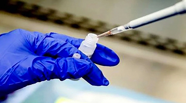 Türkiye’de bugüne kadar kaç kişiye koronavirüs testi yapıldı? Rakam belli oldu...