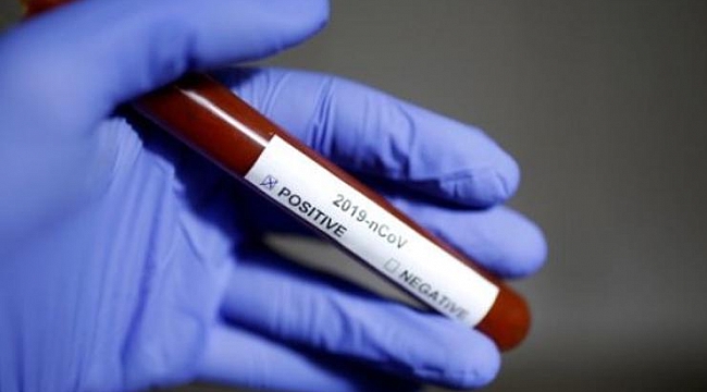 Corona virüsünde son durum: Maalesef 2 milyona dayandı