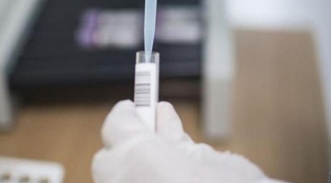 Corona virüs için yerli ilacın satışına izin