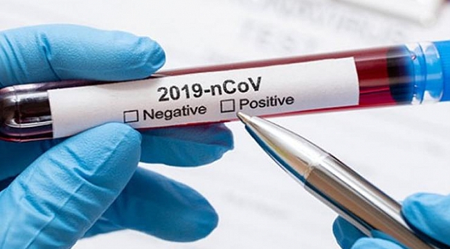 Dünya genelinde koronavirüs bilançosu!