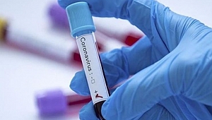 Koronavirüs testinde kriterler değişiyor!
