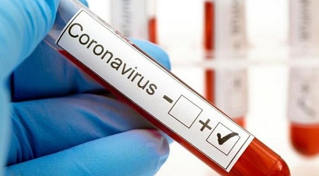 Sayılar beş gündür dört haneli! Gözler kritik toplantıda