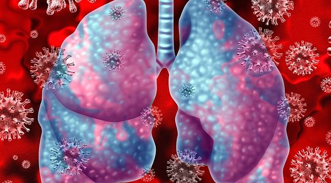 Koronavirüs son durum: Vaka sayısı 13 milyonu geçti