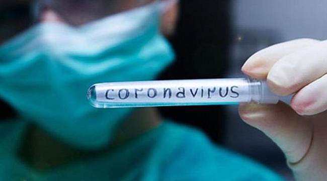 Valilik duyurdu: 102 ev karantinaya alındı!