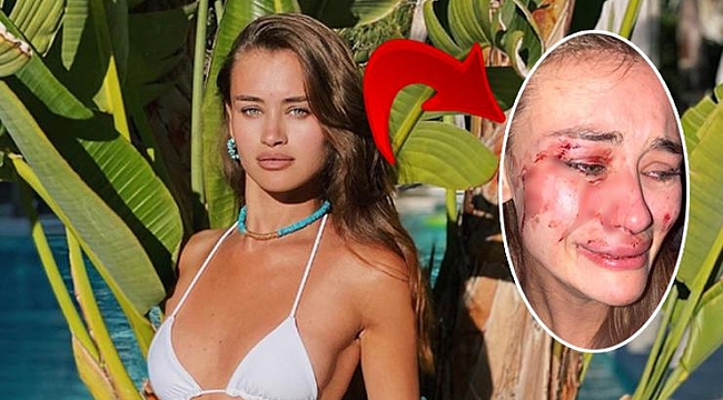 Çeşme'deki darp olayında görgü tanıkları konuştu: "Onlar görevlilere saldırdı"