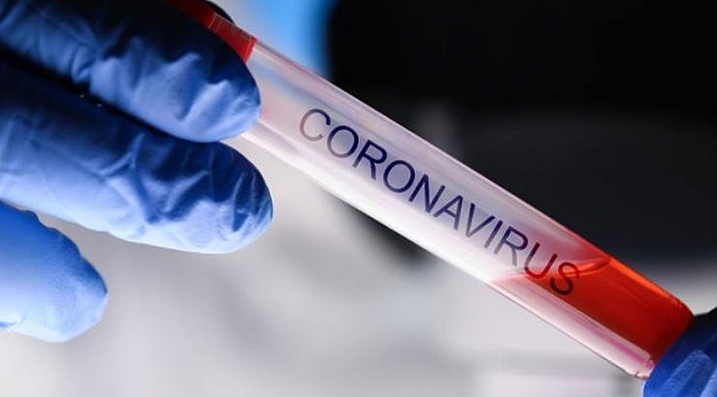 Korkulan oldu! Okullar açılır açılmaz...