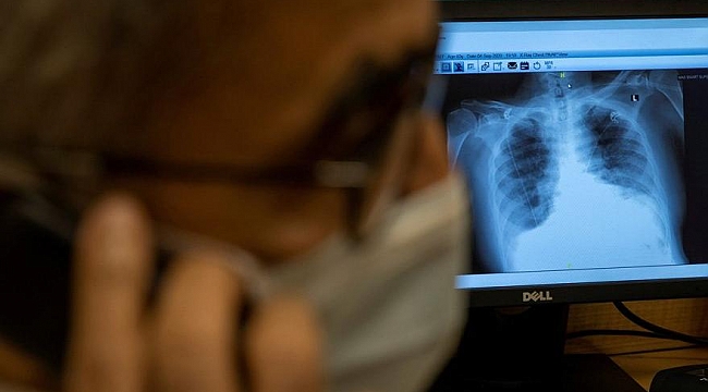 Corona virüsünü yenenlerde korkunç bulgu: 10’undan 9’unda…