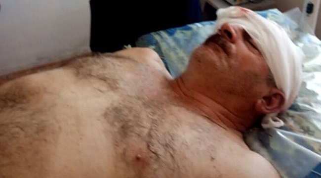 Ermenistan sivilleri vurdu! Azerbaycan'dan sert karşılık geldi