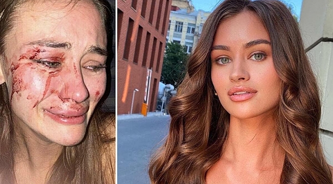 Koronaya yakalandı!