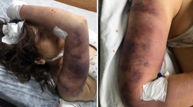 Kan donduran olay: Zincirle dövüp, tırnaklarını çekerek işkence yaptı!