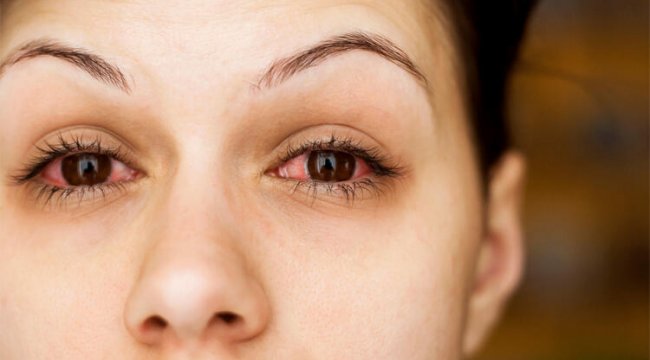 Adenovirüs koronavirüs kadar hızlı yayılabiliyor, temasla bulaşıyor!