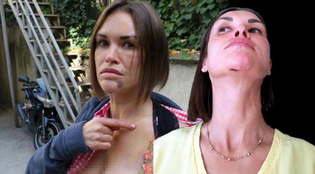 Koca şiddetiyle gündeme gelmişti! Rus kadından acı haber