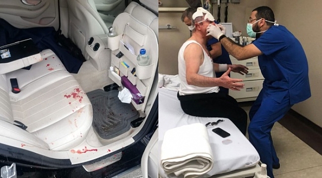 Gelecek Partisi yöneticisi Özdağ'a saldırı düzenlendi