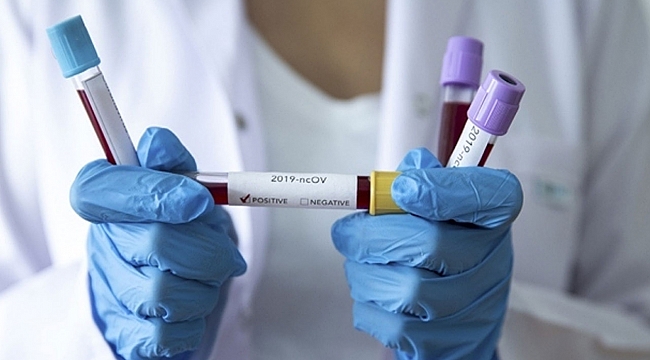 Türkiye'deki corona virüsü vaka ve ölü sayısında son durum (16 Şubat 2021)