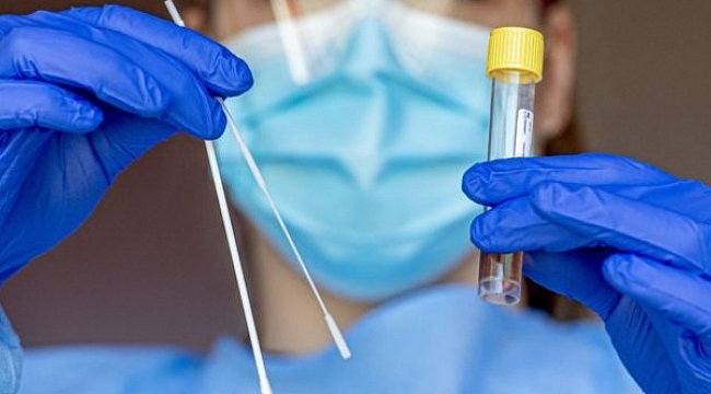 Uzmanı, vakalardaki artışın sebebini açıkladı